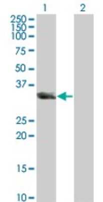 Western Blot: UNC119 Antibody (2F9-2A9) [H00009094-M01]