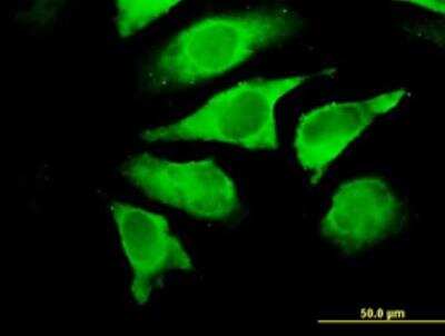 Immunocytochemistry/ Immunofluorescence: UNC119 Antibody [H00009094-B01P-50ug]