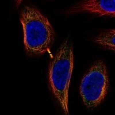 Immunocytochemistry/ Immunofluorescence: UNC119B Antibody [NBP3-17146]