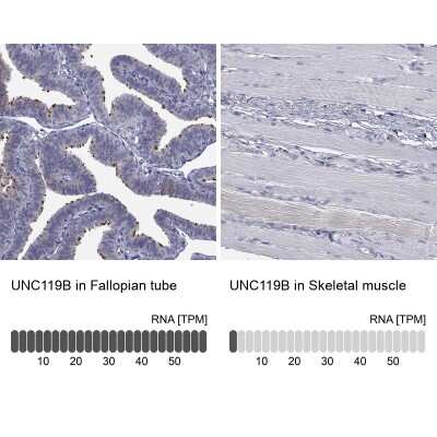 Immunohistochemistry-Paraffin: UNC119B Antibody [NBP3-17146]