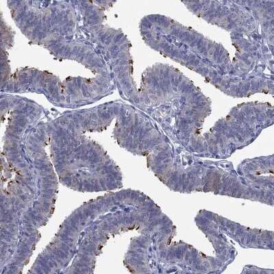 Immunohistochemistry-Paraffin: UNC119B Antibody [NBP3-17146]