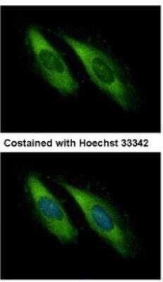Immunocytochemistry/ Immunofluorescence: UNC13D/Munc 13-4 Antibody [NBP1-31072]