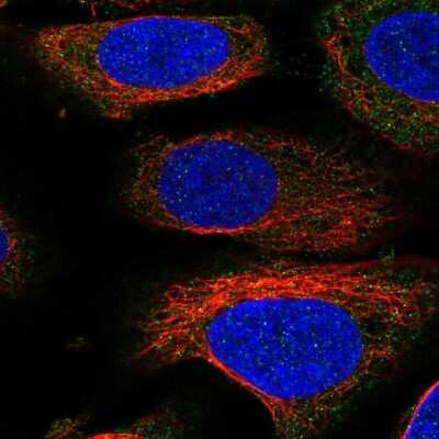 Immunocytochemistry/ Immunofluorescence: UNC13D/Munc 13-4 Antibody [NBP2-57827]
