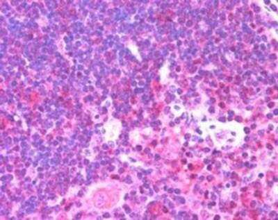 Immunohistochemistry-Paraffin: UNC13D/Munc 13-4 Antibody [NB100-41385]