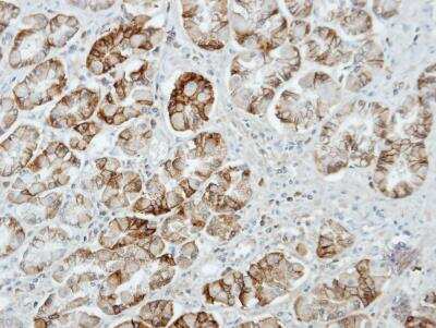 Immunohistochemistry-Paraffin: UNC13D/Munc 13-4 Antibody [NBP1-31072]