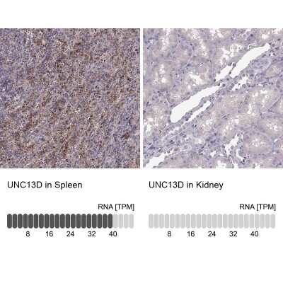 Immunohistochemistry-Paraffin: UNC13D/Munc 13-4 Antibody [NBP2-57827]