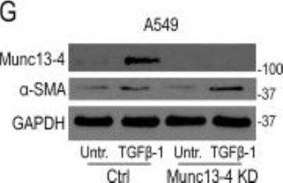 Knockdown Validated: UNC13D/Munc 13-4 Antibody [NB100-41385]
