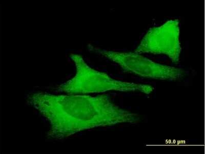 Immunocytochemistry/ Immunofluorescence: UNC45A Antibody [H00055898-B01P]