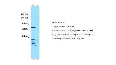 Western Blot: UNC45B Antibody [NBP2-88557]