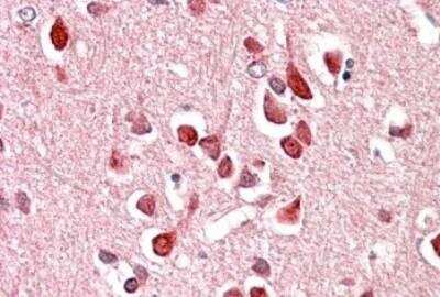 Immunohistochemistry-Paraffin: UNC5H3/UNC5C Antibody [NBP1-37002]