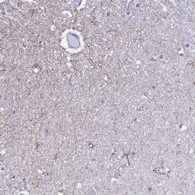 Immunohistochemistry-Paraffin: UNC80 Antibody [NBP1-94110]