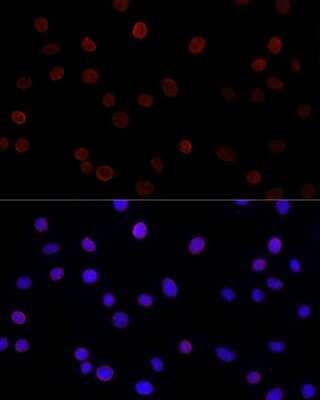 Immunocytochemistry/ Immunofluorescence: UNC84B Antibody - Azide and BSA Free [NBP2-93720]