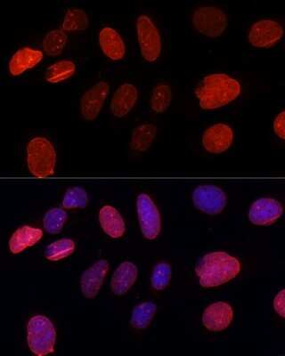 Immunocytochemistry/ Immunofluorescence: UNC84B Antibody - Azide and BSA Free [NBP2-93720]