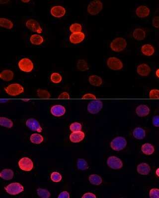 Immunocytochemistry/ Immunofluorescence: UNC84B Antibody - Azide and BSA Free [NBP2-93720]