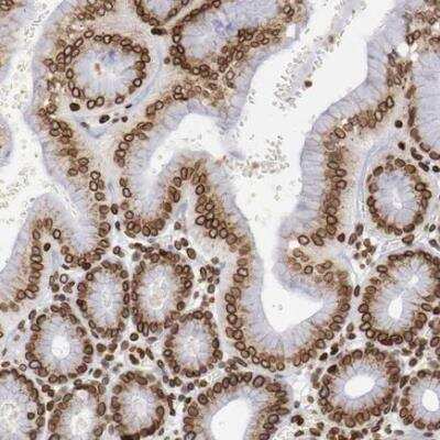 Immunohistochemistry-Paraffin: UNC84B Antibody [NBP2-62573]