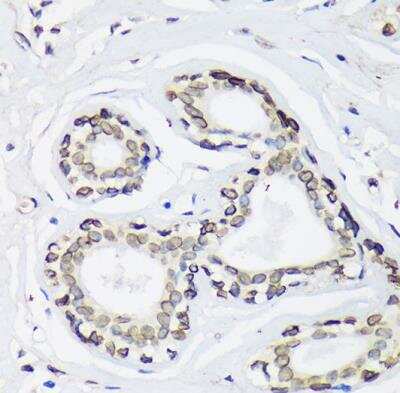 Immunohistochemistry-Paraffin: UNC84B Antibody - Azide and BSA Free [NBP2-93720]