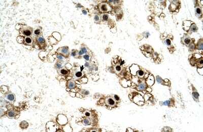 Immunohistochemistry-Paraffin: UNCX Antibody [NBP1-91314]