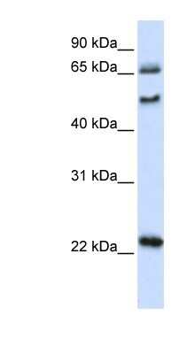 Western Blot: UNCX Antibody [NBP1-91315]
