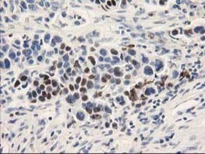 Immunohistochemistry: UNG Antibody (OTI1A11) - Azide and BSA Free [NBP2-74785]