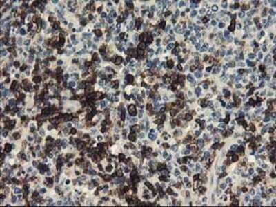 Immunohistochemistry: UNG Antibody (OTI1A11) - Azide and BSA Free [NBP2-74785]
