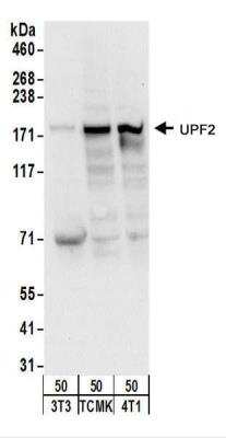 Western Blot: UPF2 Antibody [NBP2-22281]