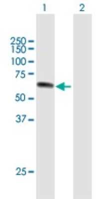 Western Blot: UPF3A Antibody [H00065110-B01P]