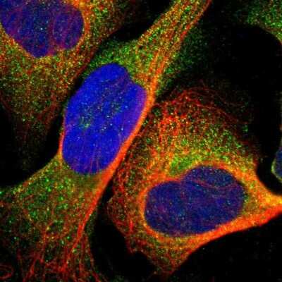 Immunocytochemistry/ Immunofluorescence: UPF3B Antibody [NBP1-83134]