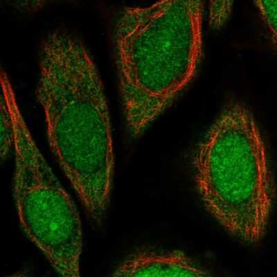 Immunocytochemistry/ Immunofluorescence: UPF3B Antibody [NBP2-55617]