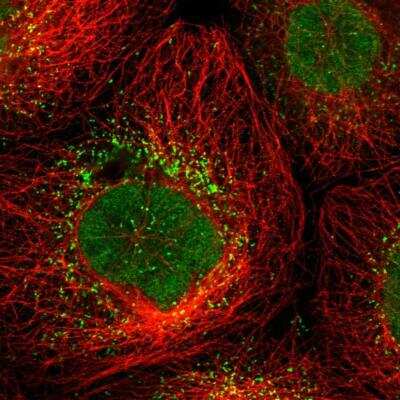 Immunocytochemistry/ Immunofluorescence: UPP2 Antibody [NBP1-80646]