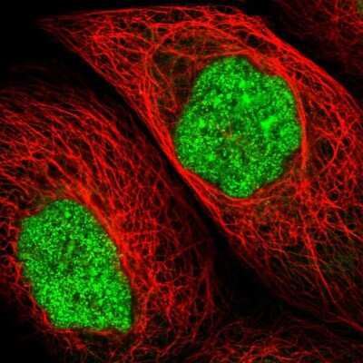Immunocytochemistry/ Immunofluorescence: UPP2 Antibody [NBP1-80647]