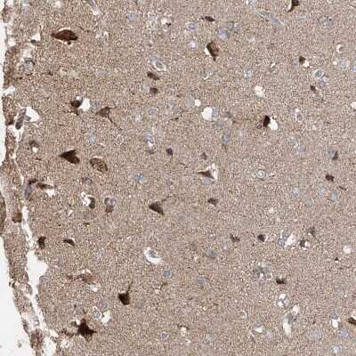 Immunohistochemistry-Paraffin: UQCC Antibody [NBP1-90766]