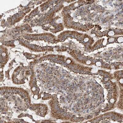 Immunohistochemistry-Paraffin: UQCC Antibody [NBP1-90766]