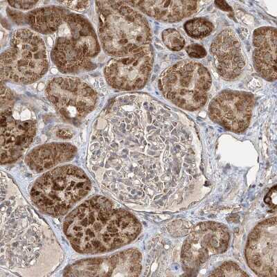 Immunohistochemistry-Paraffin: UQCC Antibody [NBP1-90766]