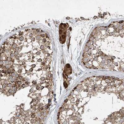 Immunohistochemistry-Paraffin: UQCC Antibody [NBP1-90766]
