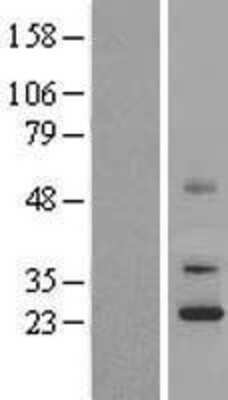 Western Blot: UQCC Overexpression Lysate [NBP2-06835]