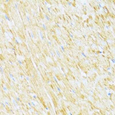 Immunohistochemistry-Paraffin: UQCR10 Antibody - BSA Free [NBP2-93778]