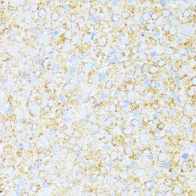 Immunohistochemistry-Paraffin: UQCR10 Antibody - BSA Free [NBP2-93778]