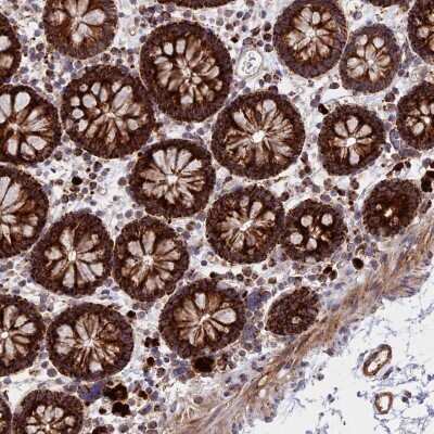 Immunohistochemistry-Paraffin: UQCRB Antibody [NBP1-80860]