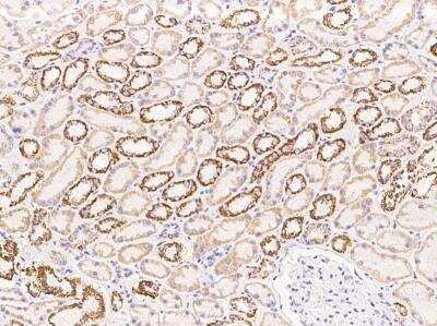 Immunohistochemistry-Paraffin: UQCRB Antibody [NBP3-12711]