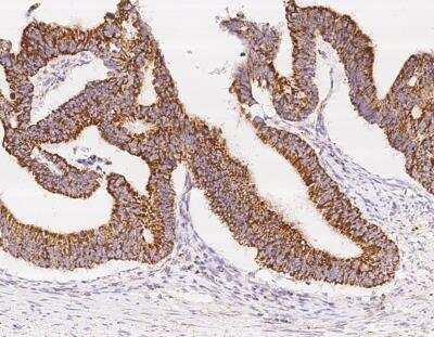 Immunohistochemistry-Paraffin: UQCRB Antibody [NBP3-12711]