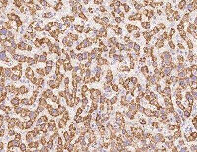 Immunohistochemistry-Paraffin: UQCRB Antibody [NBP3-12711]