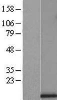 Western Blot: UQCRB Overexpression Lysate [NBL1-17628]