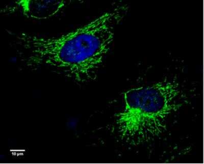 Immunocytochemistry/ Immunofluorescence: UQCRC1 Antibody (139) [NBP2-43597]