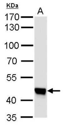 Western Blot: UQCRC1 Antibody (139) [NBP2-43597]