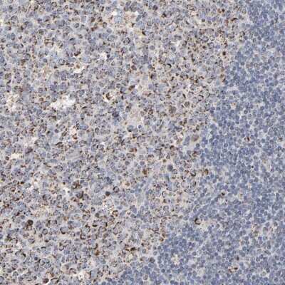 Immunohistochemistry-Paraffin: UQCRC1 Antibody [NBP1-85329]