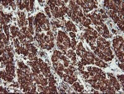 Immunohistochemistry: UQCRC1 Antibody (OTI1G6) - Azide and BSA Free [NBP2-74796]