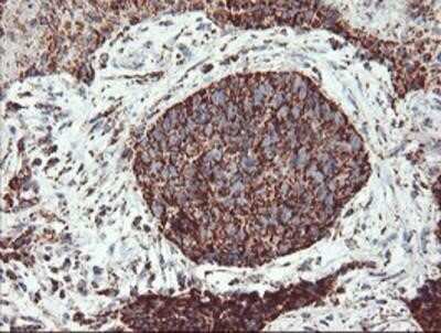 Immunohistochemistry: UQCRC1 Antibody (OTI1G6) - Azide and BSA Free [NBP2-74796]