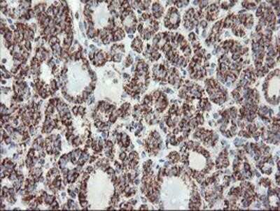 Immunohistochemistry: UQCRC1 Antibody (OTI1G6) - Azide and BSA Free [NBP2-74796]