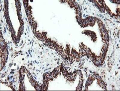 Immunohistochemistry-Paraffin: UQCRC1 Antibody (OTI1G6) [NBP2-03825]