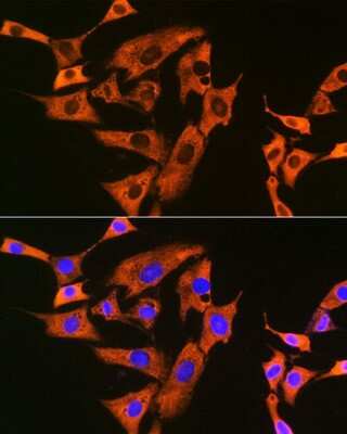 Immunocytochemistry/ Immunofluorescence: UQCRFS1 Antibody (0O9Z10) [NBP3-16812]